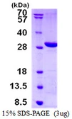 Human LYPLAL1 protein, His tag. GTX57325-pro