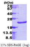 Human NUDT10 protein, His tag. GTX57378-pro