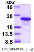 Human ARL5B protein, His tag. GTX57391-pro