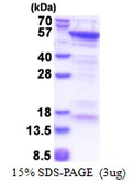 Human CUEDC1 protein, His tag. GTX57433-pro