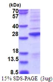 Human SSX2 protein, His tag. GTX57454-pro