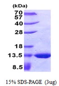 E. coli glpE protein, His tag. GTX57489-pro