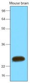 Anti-SNAP25 antibody [4E11] used in Western Blot (WB). GTX57559
