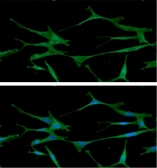 Anti-ARF1 antibody [1B3] used in Immunocytochemistry/ Immunofluorescence (ICC/IF). GTX57579