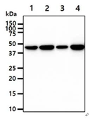 Anti-Creatine kinase (brain) antibody [AT8E4] used in Western Blot (WB). GTX57675