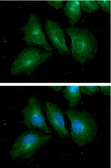 Anti-RAB7A antibody [AT10E4] used in Immunocytochemistry/ Immunofluorescence (ICC/IF). GTX57709
