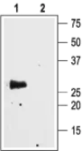 Anti-Aquaporin 4 antibody used in Western Blot (WB). GTX57734