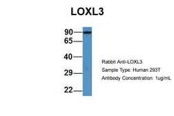 Anti-LOXL3 antibody used in Western Blot (WB). GTX57750