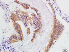 Anti-IEX1 antibody used in IHC (Paraffin sections) (IHC-P). GTX60211