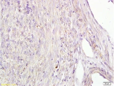 Anti-Alpha fetoprotein / AFP antibody [A2] used in IHC (Paraffin sections) (IHC-P). GTX60214