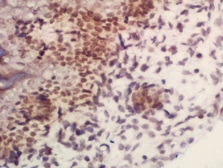 Anti-ARID1B antibody used in IHC (Paraffin sections) (IHC-P). GTX60275