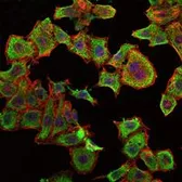 Anti-RBP4 antibody [4C2] used in Immunocytochemistry/ Immunofluorescence (ICC/IF). GTX60427