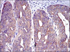 Anti-CBL antibody [3B12] used in IHC (Paraffin sections) (IHC-P). GTX60481