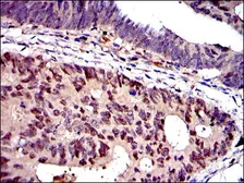 Anti-MCM2 antibody [2B3] used in IHC (Paraffin sections) (IHC-P). GTX60491
