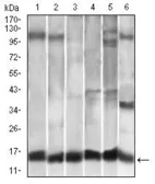 Anti-MCP1 / CCL2 antibody [2D8] used in Western Blot (WB). GTX60582