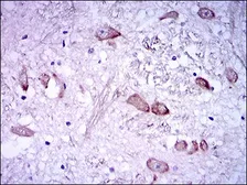 Anti-NF-H antibody [8H10] used in IHC (Paraffin sections) (IHC-P). GTX60650