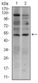 Anti-Brachyury antibody [1H9A2] used in Western Blot (WB). GTX60654