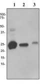 Anti-C1qC antibody [EPR2983] used in Western Blot (WB). GTX62147