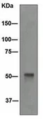 Anti-Cytokeratin 14 antibody [EPR1612] used in Western Blot (WB). GTX62683