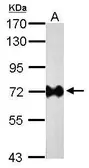 Anti-Helicobacter pylori urease B antibody [GT1263] used in Western Blot (WB). GTX627292