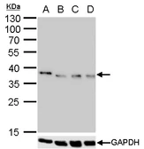 Anti-Nanog antibody [GT3312] used in Western Blot (WB). GTX627421