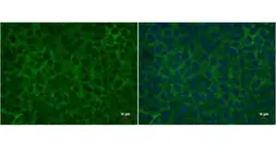 Anti-Lin28A antibody [GT1086] used in Immunocytochemistry/ Immunofluorescence (ICC/IF). GTX628139