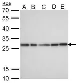 Anti-HMGB1 antibody [GT383] used in Western Blot (WB). GTX628834
