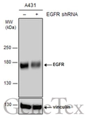 Anti-EGFR antibody [GT133] used in Western Blot (WB). GTX628887