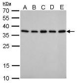 Anti-PEX19 antibody [GT533] used in Western Blot (WB). GTX628892