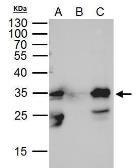 Anti-GFP antibody [GT7312] used in Immunoprecipitation (IP). GTX628894