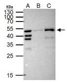 Anti-RFP antibody [GT1433] used in Immunoprecipitation (IP). GTX628898