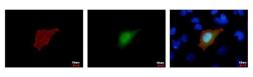 Anti-Strep epitope Tag antibody [GT517] used in Immunocytochemistry/ Immunofluorescence (ICC/IF). GTX628899