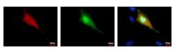 Anti-Strep epitope Tag antibody [GT661] used in Immunocytochemistry/ Immunofluorescence (ICC/IF). GTX628900