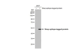 Anti-Strep epitope Tag antibody [GT661] used in Western Blot (WB). GTX628900
