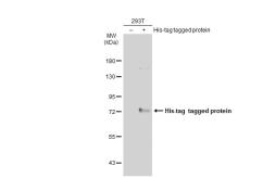 Anti-6X His tag antibody [GT359] (HRP) used in Western Blot (WB). GTX628914-01