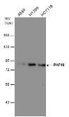 Anti-PAF49 antibody [GT1964] used in Western Blot (WB). GTX629115