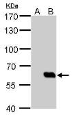 Anti-HA tag antibody [GT134] used in Western Blot (WB). GTX629540