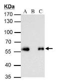 Anti-DDDDK tag antibody [GT231] used in Immunoprecipitation (IP). GTX629631