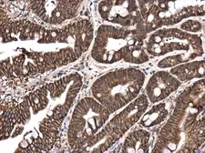 Anti-E-Cadherin antibody [GT477] used in IHC (Paraffin sections) (IHC-P). GTX629691