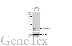 Anti-Vimentin antibody [GT812] used in Western Blot (WB). GTX629744
