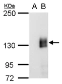 Anti-mCherry antibody [GT857] used in Western Blot (WB). GTX630189