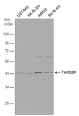Anti-TDP43 antibody [GT225] used in Western Blot (WB). GTX630196