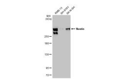 Anti-Nestin antibody [GT623] used in Western Blot (WB). GTX630201