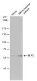 Anti-ELP3 antibody [GT11811] used in Western Blot (WB). GTX631395