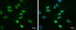 Anti-TDG antibody [GT1142] used in Immunocytochemistry/ Immunofluorescence (ICC/IF). GTX631934