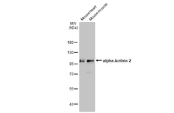 Anti-alpha Actinin 2 antibody [GT1253] used in Western Blot (WB). GTX632361