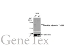 Anti-Paxillin (phospho Tyr118) antibody [GT712] used in Western Blot (WB). GTX633633