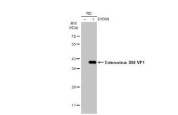 Anti-Enterovirus D68 VP1 antibody [GT1843] used in Western Blot (WB). GTX633770