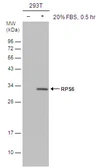Anti-RPS6 (phospho Ser235) antibody [GT4610] used in Western Blot (WB). GTX633811