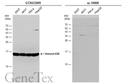 Anti-Histone H2B antibody [GT387] used in Western Blot (WB). GTX633909